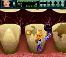 Rex Ronan - Experimental Surgeon (SNES)